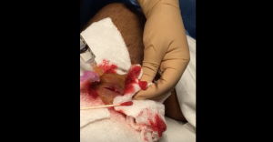 Steph infection treatment