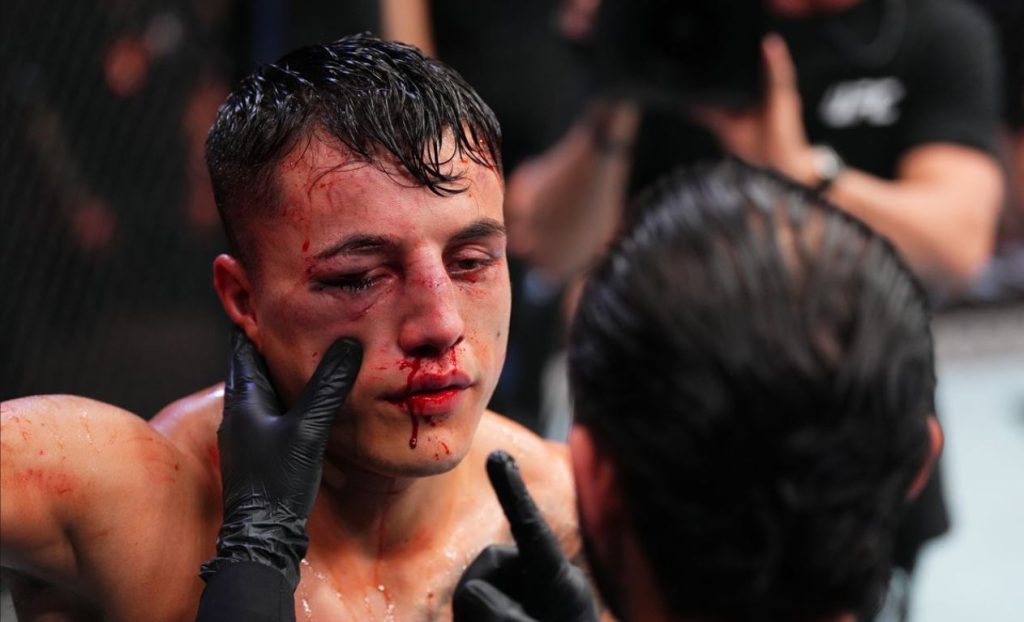 Francisco Prado, UFC Mexico City, UFC