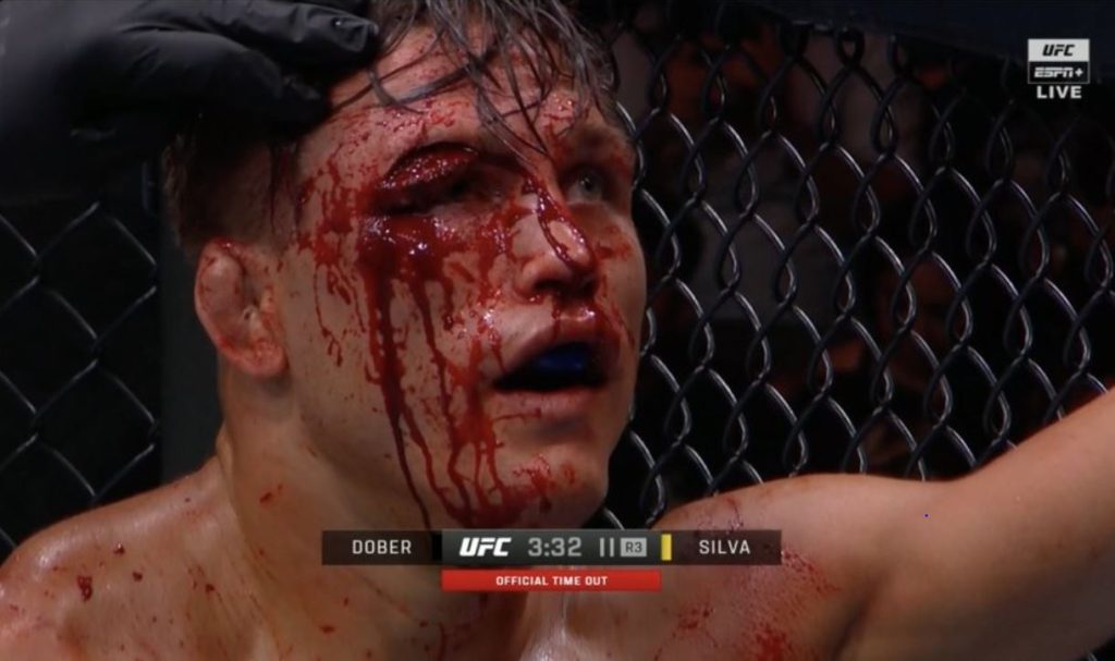 Drew Dober, UFC Denver, UFC, Pros react