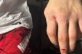 Umar Nurmagomedov