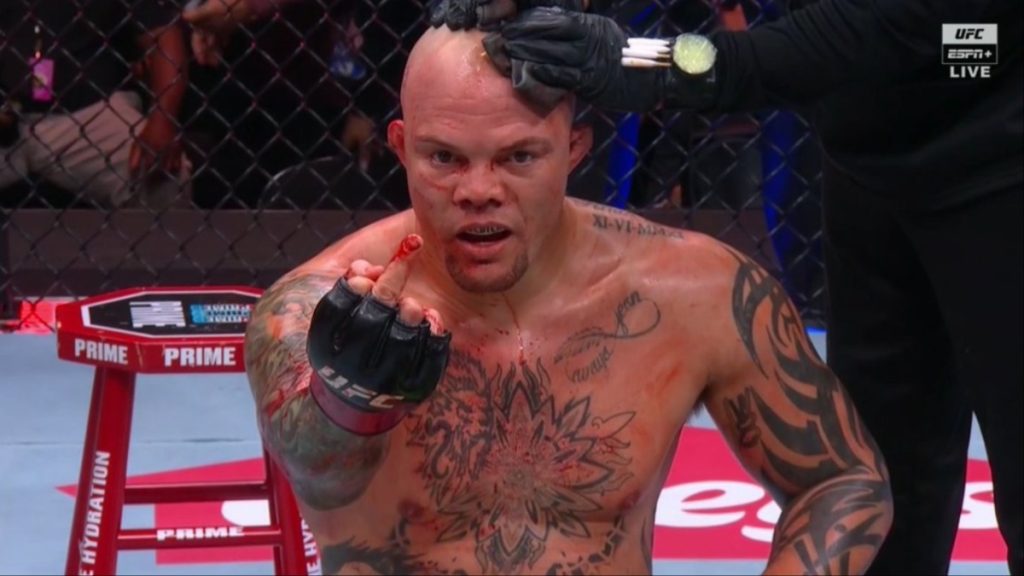 Anthony Smith