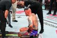Anthony Smith UFC Kansas City