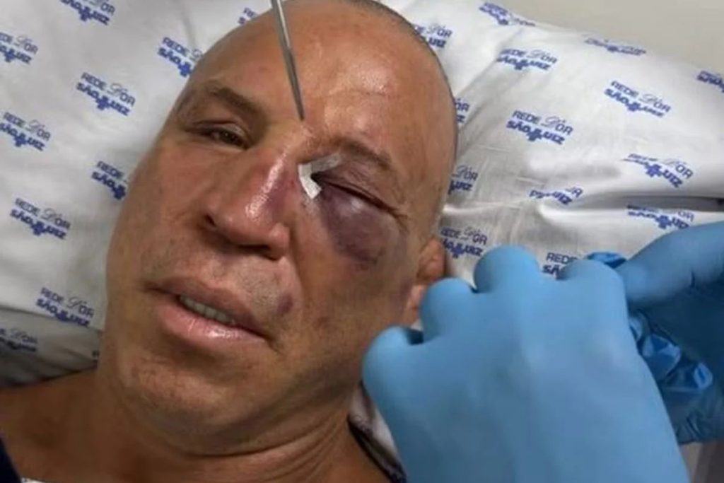 Wanderlei Silva hospital