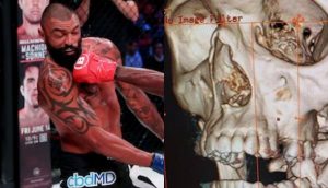 Liam McGeary